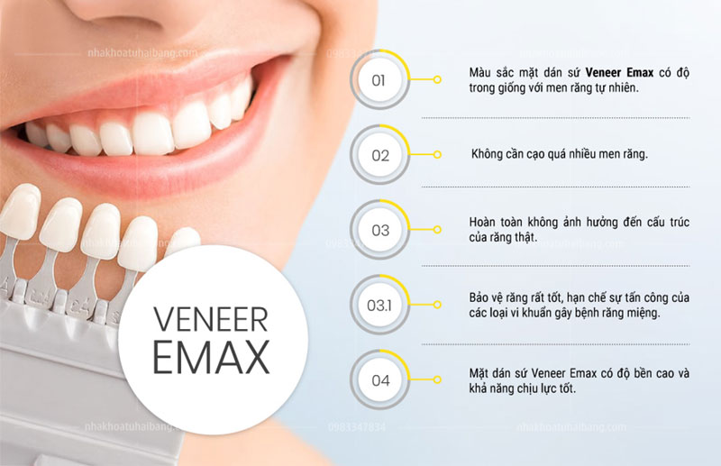 Quy trình thực hiện dán mặt sứ veneer