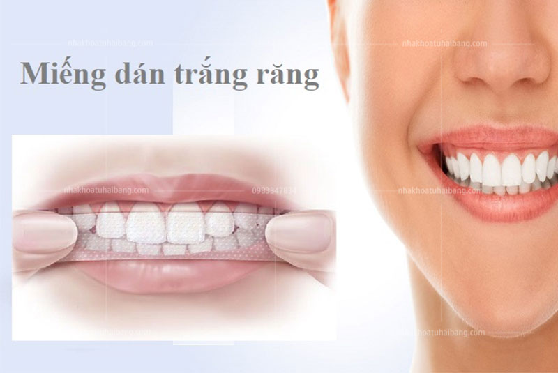 Có nên sử dụng miếng dán trắng răng không?